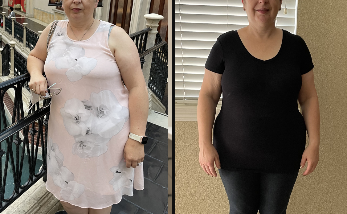 Achieve Weight Loss with Semaglutide Prescription Online